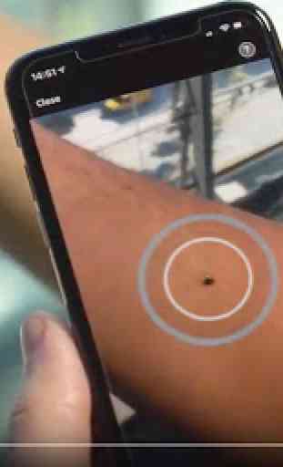 SkinVision - Detect Skin Cancer. Track your Moles. 1