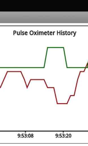 SimpleEye Live Pulse Oximeter 3