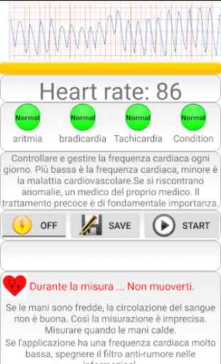 Diagnosi cardiaca (aritmia) 2