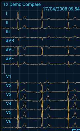 Cardiax Mobile ECG 1