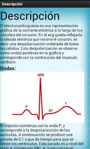 Electrocardiograma 1
