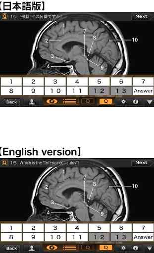 Interactive CT & MRI Anat.Lite 4