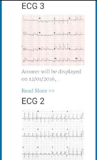 Diagnose ECG 2