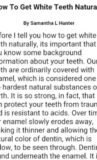 Teeth Whitening 2