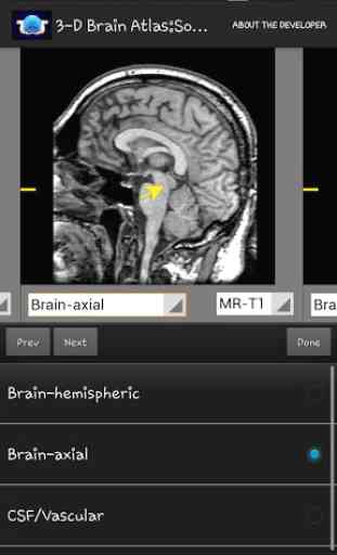 3-D brain Atlas 3
