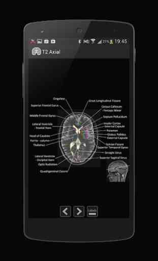 Atlas of MRI Brain Anatomy 2