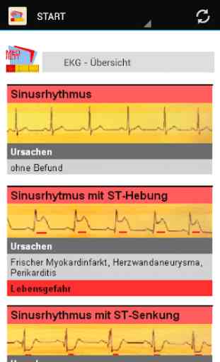 EKG-Monitoring 3