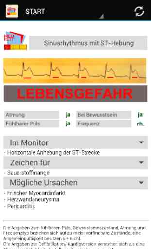 EKG-Monitoring 4
