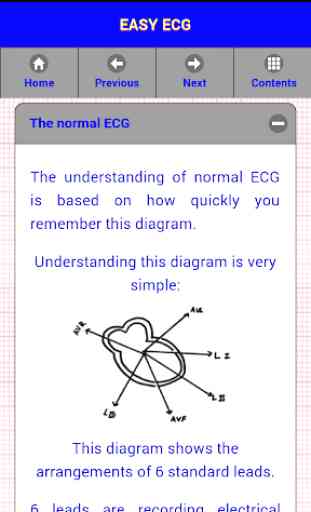 Easy ECG 3
