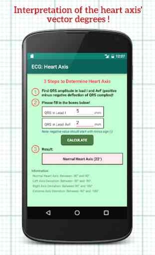 Electrocardiogram (ECG) Pro: Heart Axis 2