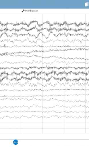 NeuroCenter EEG 3