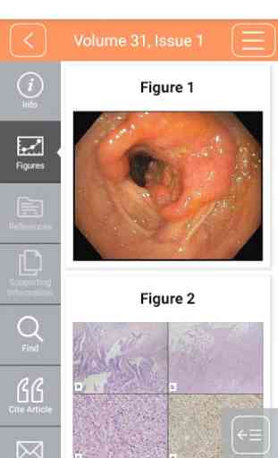 Jnl Gastroenterology & Hepatol 2