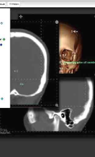 Imaging Anatomy - CT MRI XR US 3