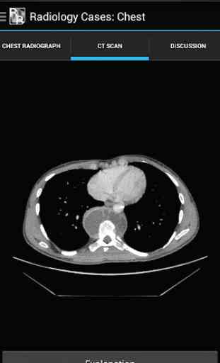 Radiology Cases: Chest 1