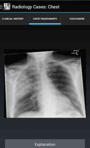 Radiology Cases: Chest 2