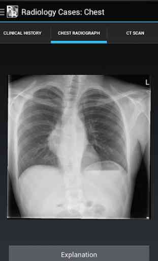 Radiology Cases: Chest 3
