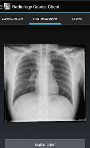 Radiology Cases: Chest 4