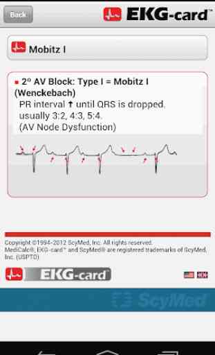 EKG-card™ 4