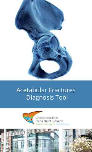 Acetabular Fractures Diagnosis 1