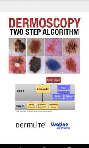 Dermoscopy Two Step Algorithm 1