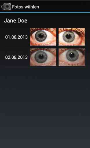 Eye Diagnosis 1
