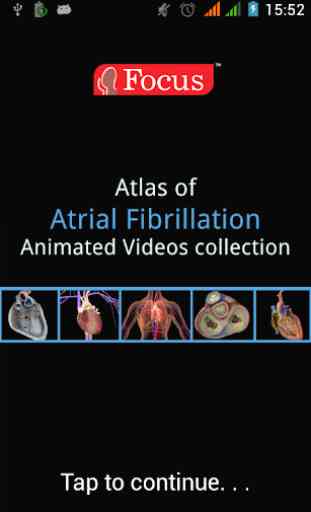 Atlas of Atrial Fibrillation 1
