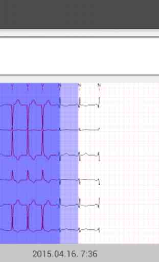 Cardiospy Mobile ECG 3