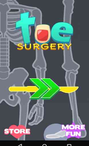 Toe Foot Surgery Doctor 2