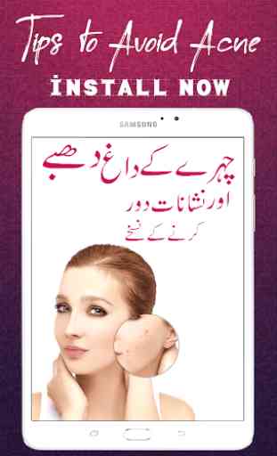 Face Pimples Home Remedy Solutions – Urdu Tips 1