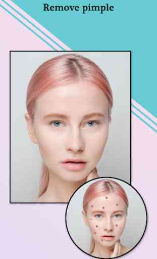 Pimple Remover, Eraser - Face Beauty Maker 3