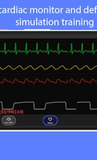 Simpl - Simulated Patient Monitor 1