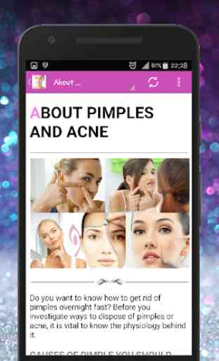 Skin Treatment - Get Rid Of Acne And Pimples Natur 2
