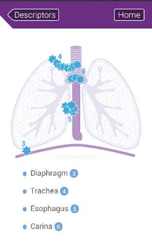 TNM Lung Staging 3