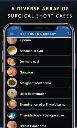 Short Cases in Surgery 3