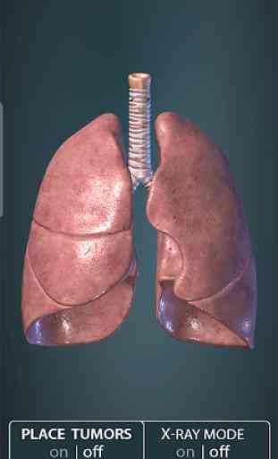Surgical Anatomy of the Lung 1