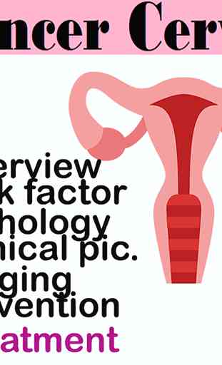 Cancer Cervix Fact 1