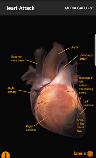 CardioSmart Heart Explorer 4