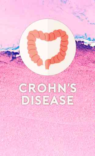 Crohn's Disease 1
