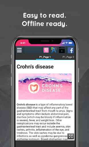 Crohn's Disease 2