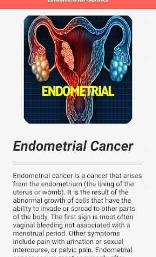 Endometrial Cancer 3