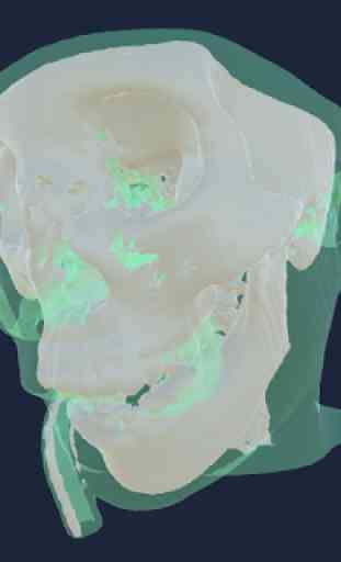 CT Scan Viewer 3D 2