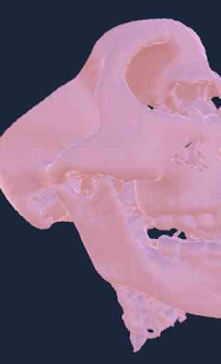 CT Scan Viewer 3D 3