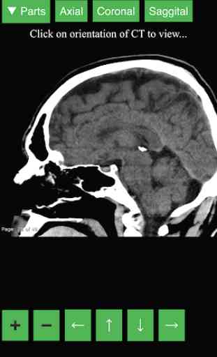 Radiology CT Viewer 2