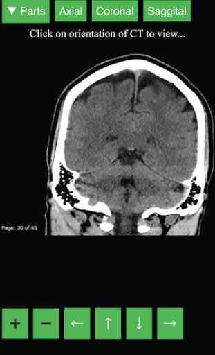 Radiology CT Viewer 3