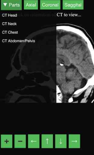 Radiology CT Viewer 4