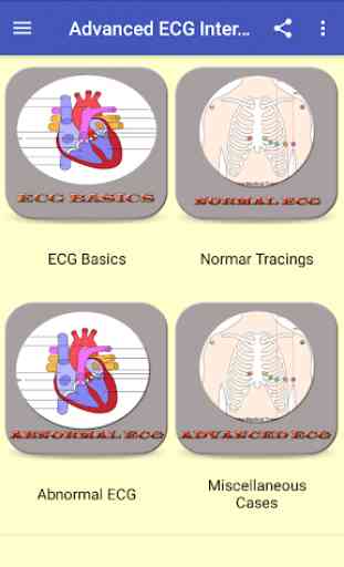 Advanced ECG Interpretation 2