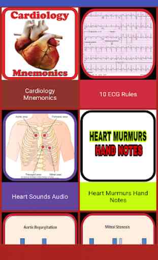 Cardiology Mnemonics, ECG, Heart Sounds & Murmurs 1