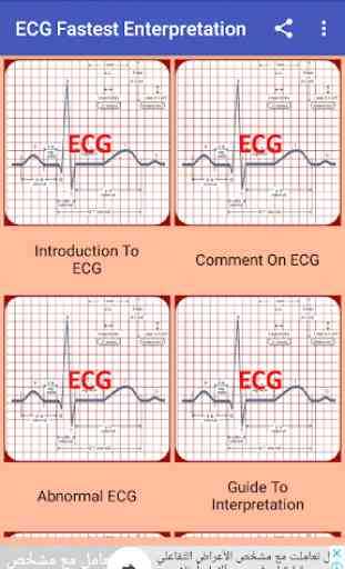 ECG Interpretation Made Easy 1