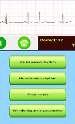 ECG Rhythm Quiz 3