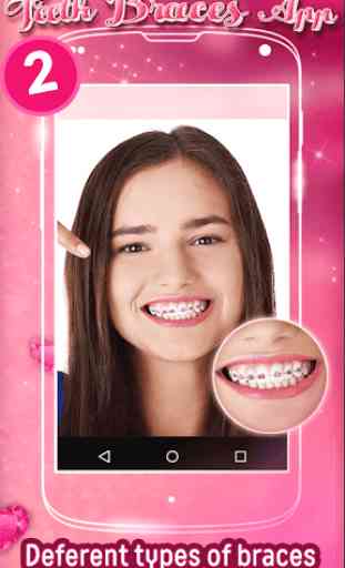Teeth Braces App 2 1